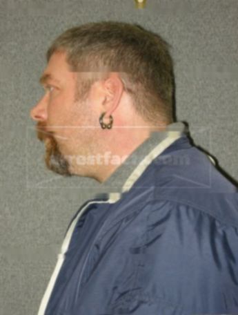 Chad M Lattimer