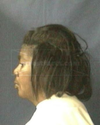 Verna J Phillips