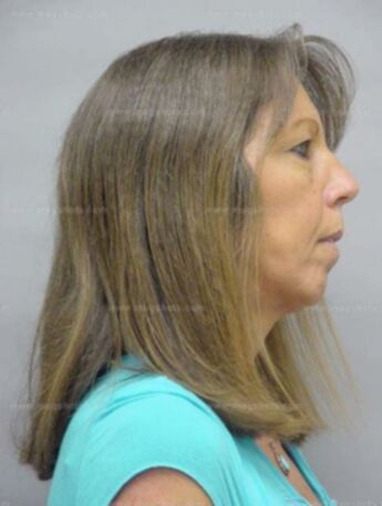 Laurie Ellen Brunet