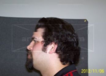 Zachary W Karberg