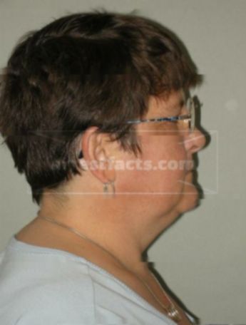 Peggy A Kolinski
