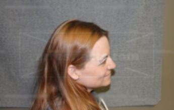 Kathryn L Bergstedt