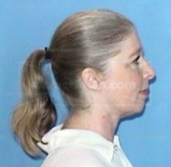 Carol L. Purdue