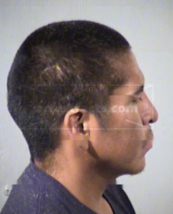 Charlton Zimmerman Dukepoo