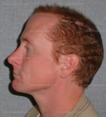 Conor T Reardon