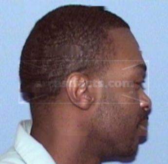 Antione Dorris