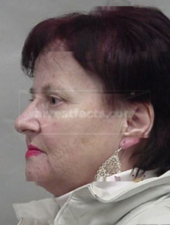 Ewa E Bielecka