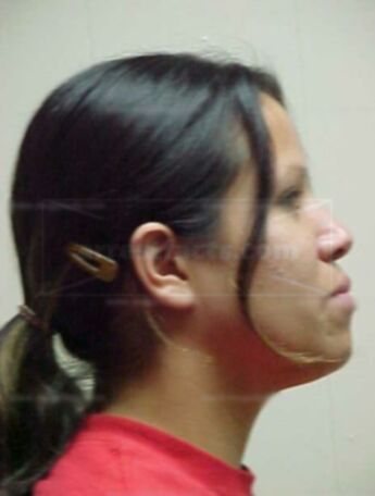 Heather Rose Blackfeet