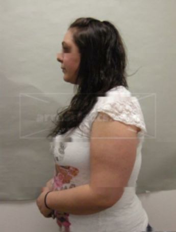 Melissa S Dennison