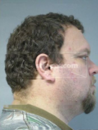 Brian G Jacobson