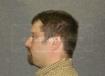 Joseph P Schneider