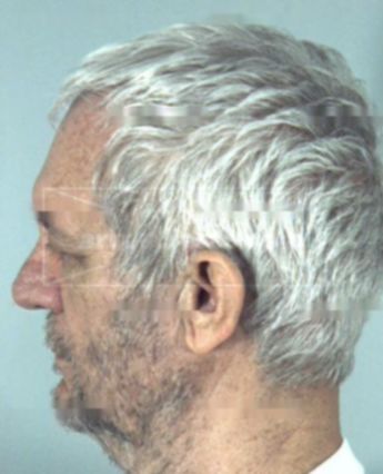 James Douglas Stump