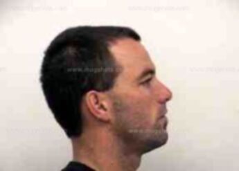Timothy Brinson Siebold