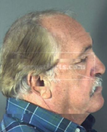 Robert Glenn Cunningham