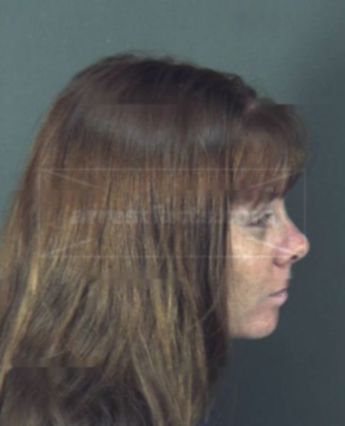 Patricia Lynn Kenmore