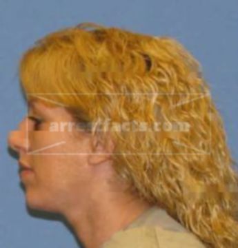 Angela L Corlett