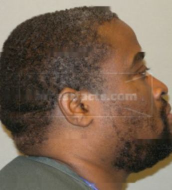 Tyrone Graffree