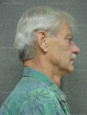 Thomas J Woehrer