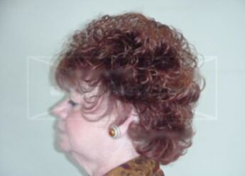 Patricia A Kurtz