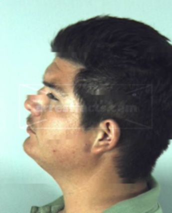 Carlos Vidales