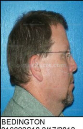 William David Bedington