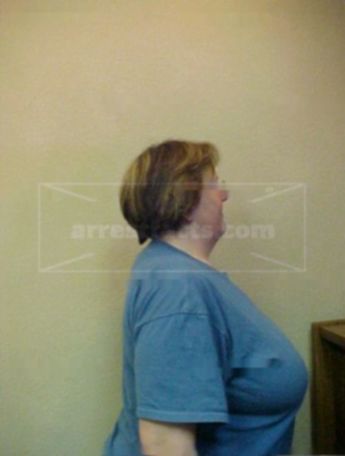 Nancy Riggs