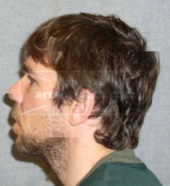 Gilbert Joseph Grobstick