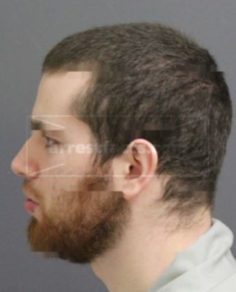 Alexander Justice Brevig
