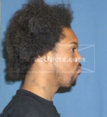 Sedrick L Burns
