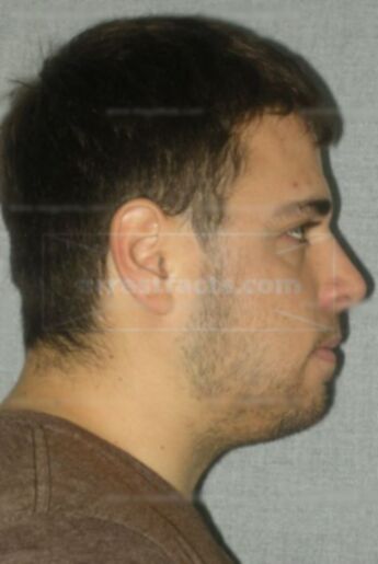 Michael J Grabowski