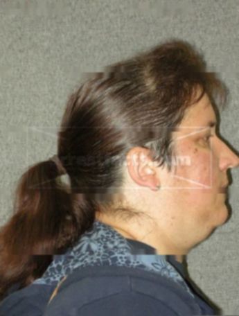 Janice M Klade