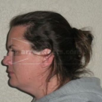 Christina L Talbert