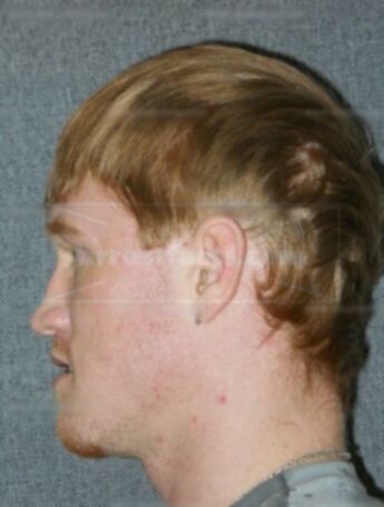 Jerid D Putzke
