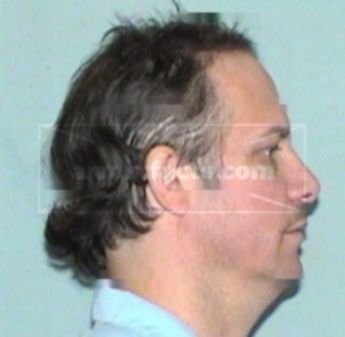 Richard D. Borgra