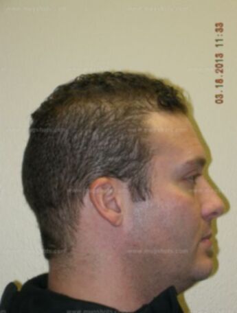 Travis B Jorgensen
