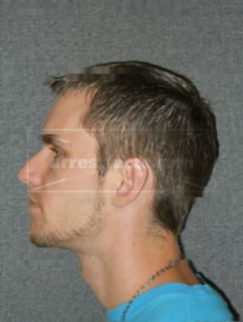 Matthew G Grunke