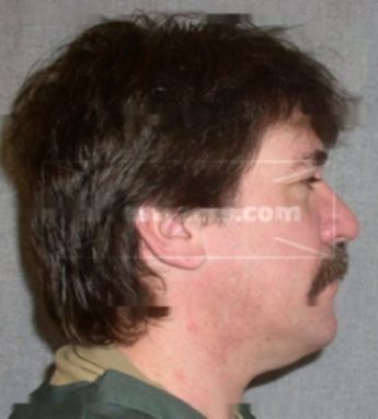 Patrick J Steiner