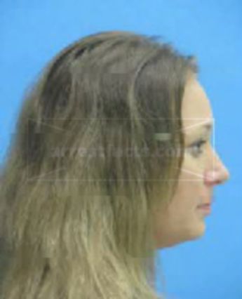 Christine Anne Kovari