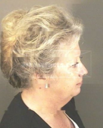 Joanne Kay Singleton