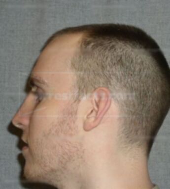 Chase C Retzer