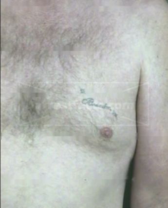 Victor Fritz Brossiet