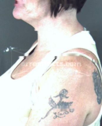 Melissa Terry Kent