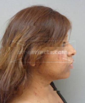 Idalia Bolanos