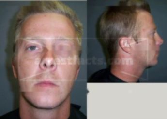 Kenneth Anthony Hope