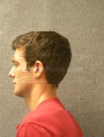 Logan M Volkey