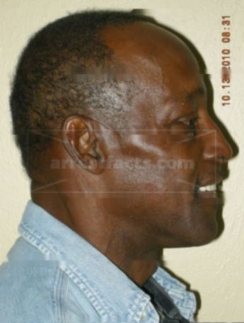 Anderson L Dotson