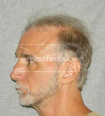 Bernard Leon Beyer
