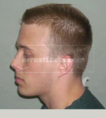 Justin A Olson