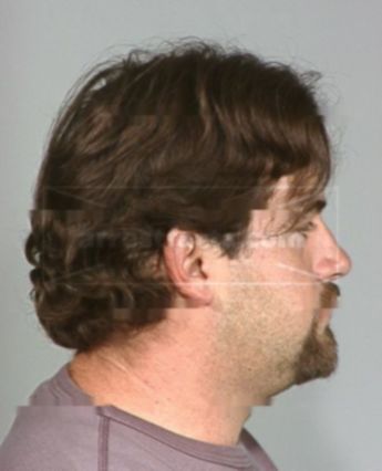 Paul Randal Nebel