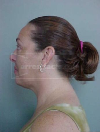 Rhonda J Ayres